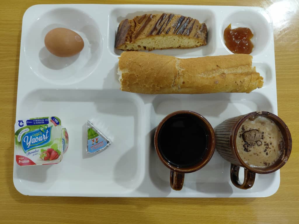 إ ج عينوش شامة 